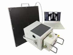 触摸屏便携式X光机100mA
